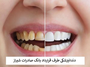 دندانپزشکی طرف قرارداد بانک صادرات شیراز